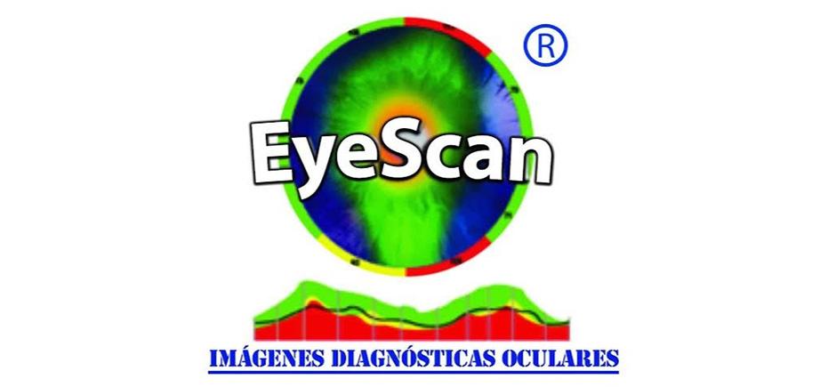 EyeScan
